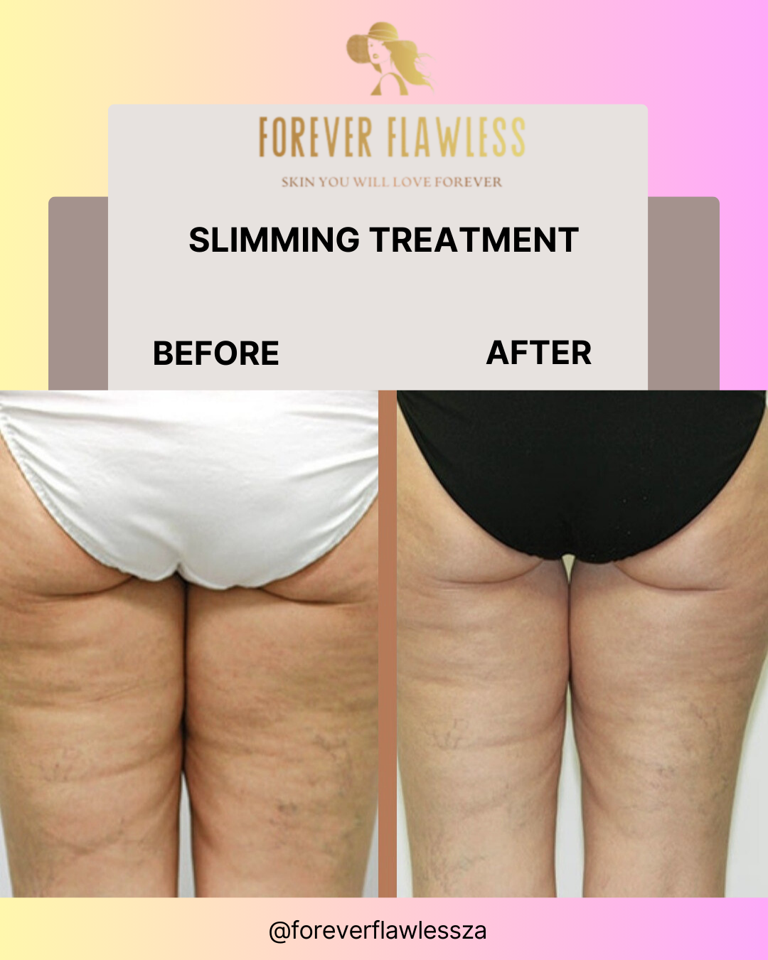 Body Bliss Package