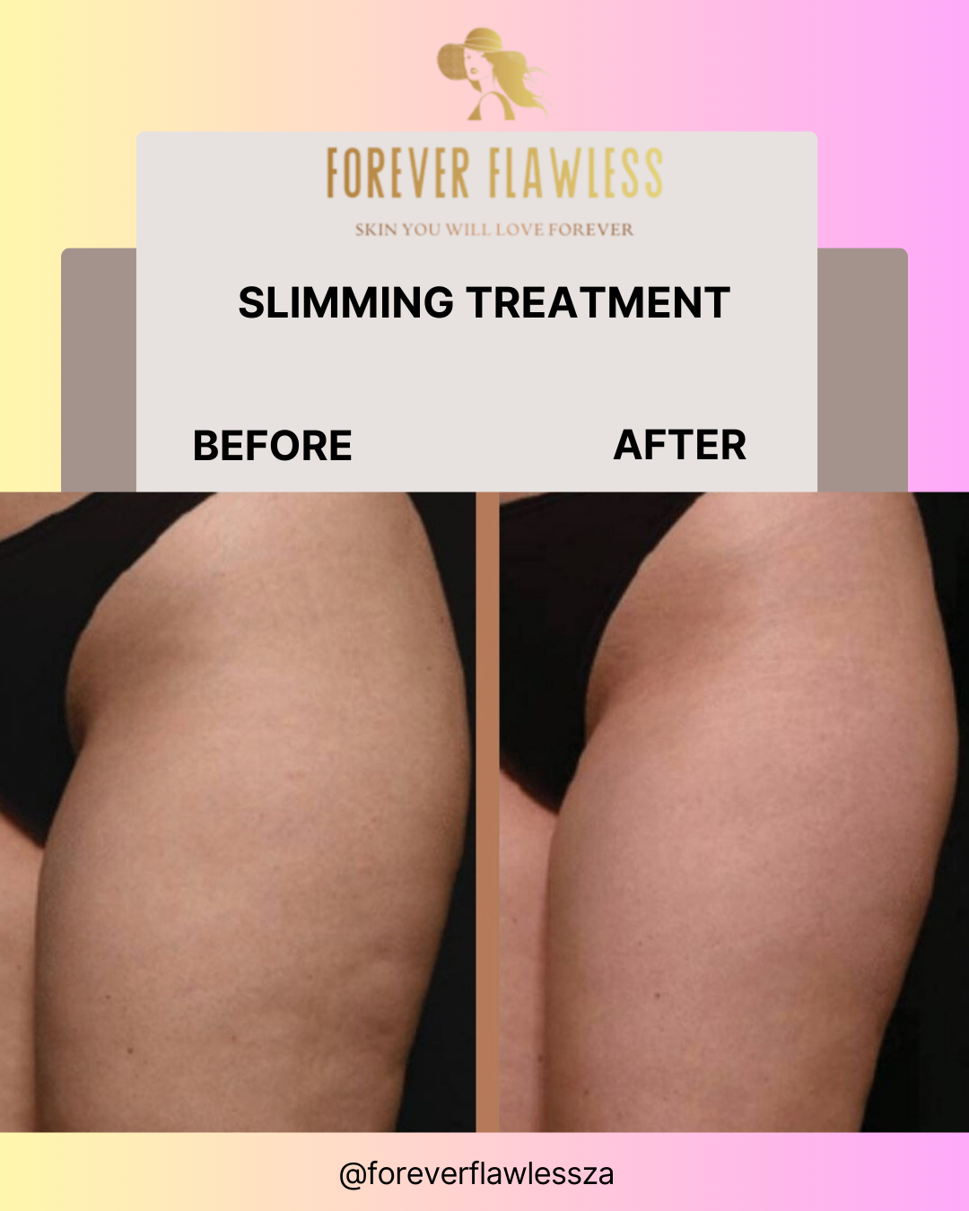 Body Bliss Package