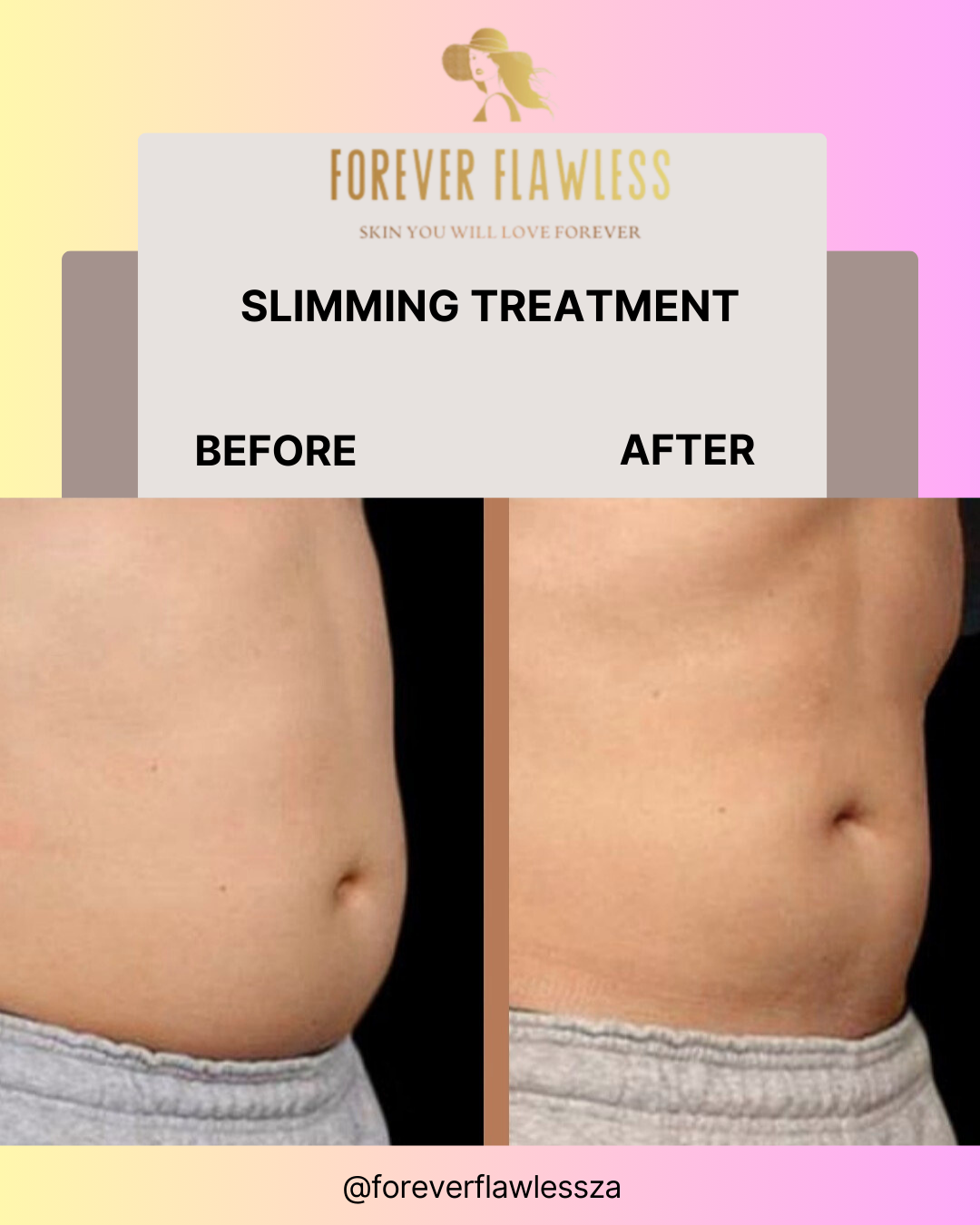Body Bliss Package