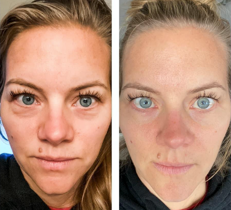 ageLOC LumiSpa IdealEyes – Brightening Eye Cream 15ML